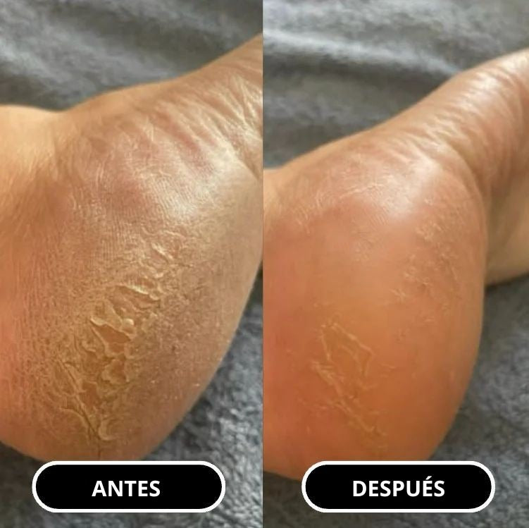 Barra para cuidado de pies  Alheya