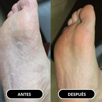 Barra para cuidado de pies  Alheya